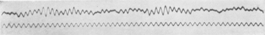 Two wavering ink traces on a strip of paper: the first recorded human electroencephalogram above a regular timing wave.